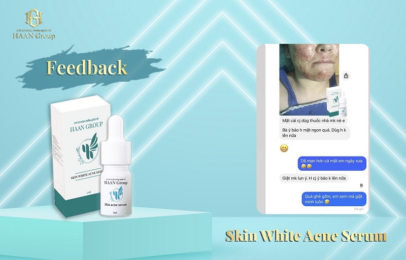 Tinh chất Skin Acne Serum nhận được sự tin tưởng của khách hàng